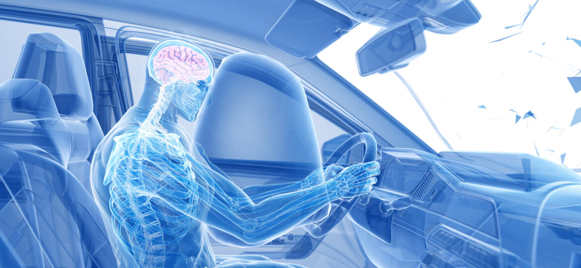 Car Accidents Cause Back Pain