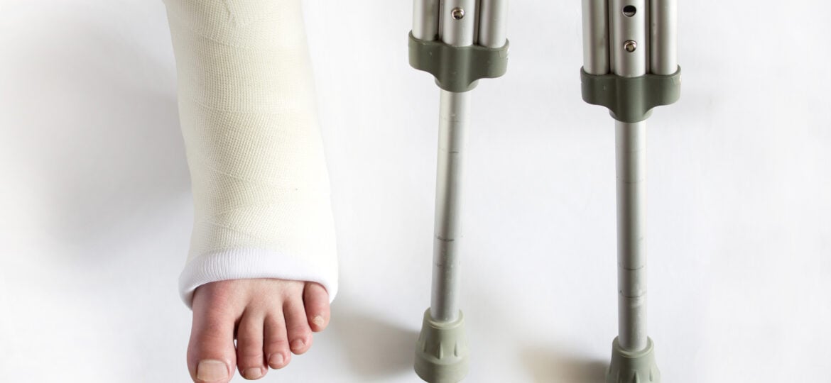 Broken Bone Settlements