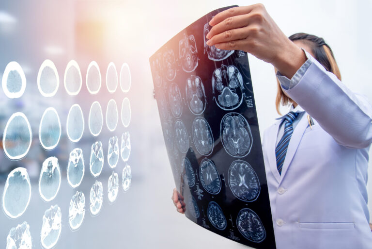 Riverdale brain injury lawyer, Riverdale traumatic brain injury attorney; Riverdale head injury lawyer; Iowa traumatic brain injury claim